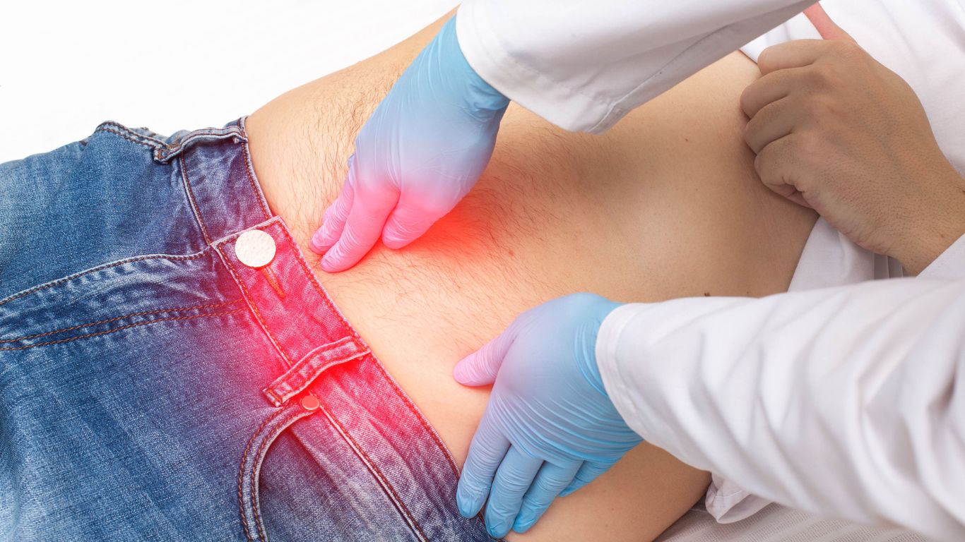 How To Get Rid of Hernia – Causes and Solution