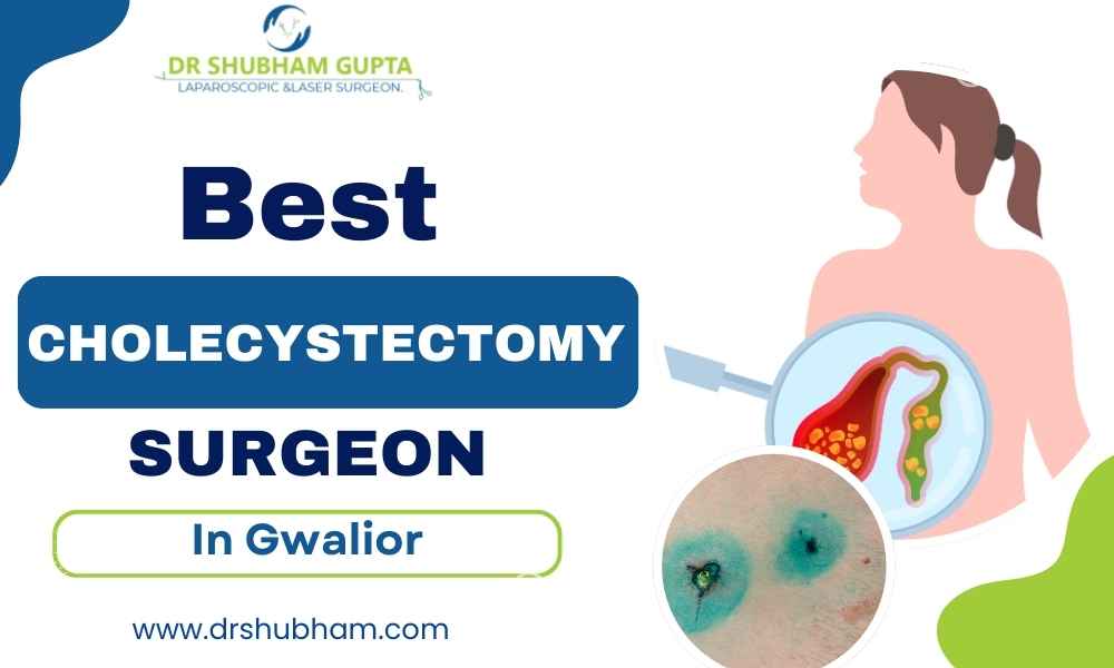 Best Cholecystectomy Surgeon in Gwalior – Dr. Shubham Gupta